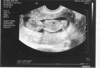 Se Acerca el Momento